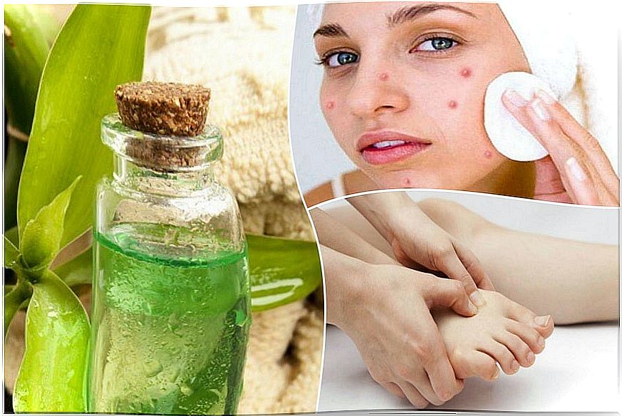 7 medicinal applications of tea tree oil that you will like to know