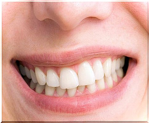 8 factors that turn teeth yellow