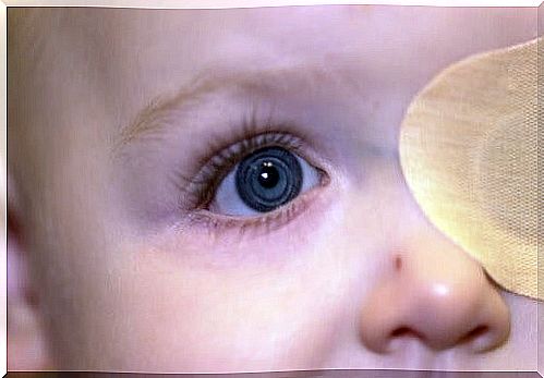 congenital cataracts