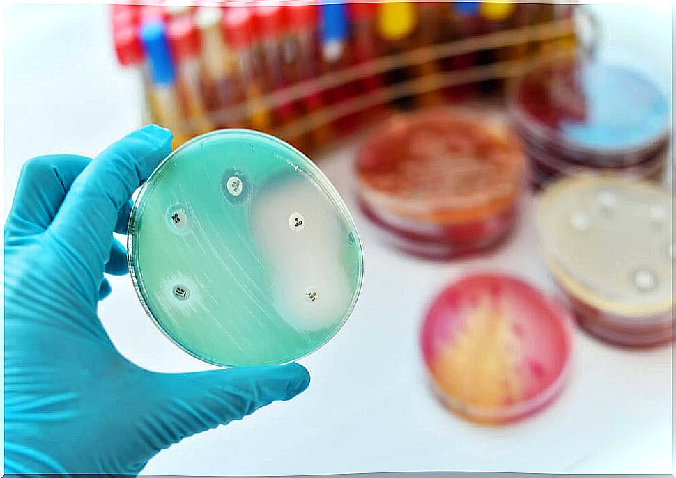 diagnosis of coccidioidomycosis