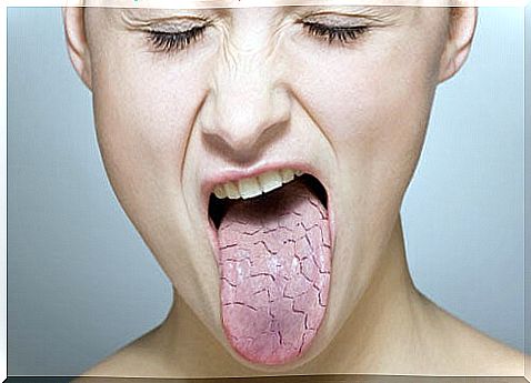 How to eliminate the feeling of dry mouth: 4 natural remedies