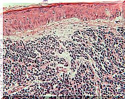 Merkel cells