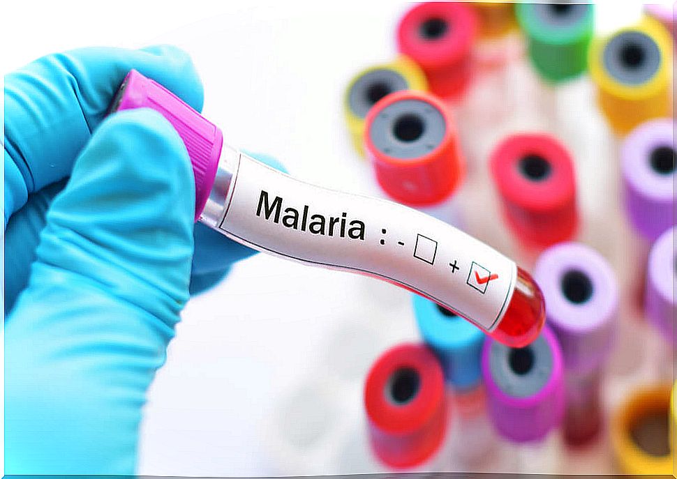 Blood test in case of malaria.